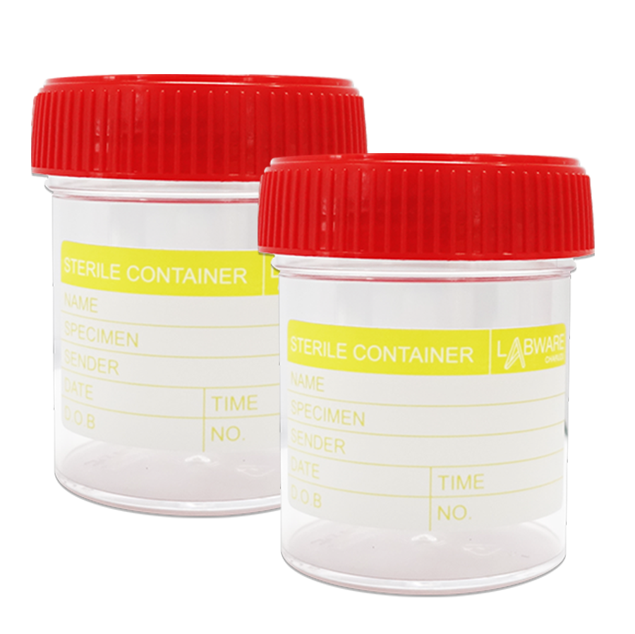 Sample Container 60ml SPECIMEN CONTAINER 60 ML (STERILE) PS RED | Agarindo Biological Company